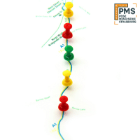 étapes de votre chantier cuisine à Strasbourg